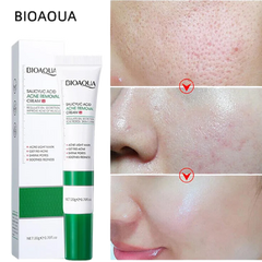Bioaqua Salicylic Acid Acne Removal Cream Pores Oil Control Treatment